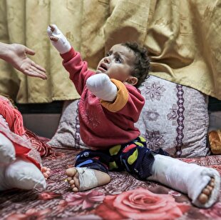 Gaza; Home to the largest group of child amputees