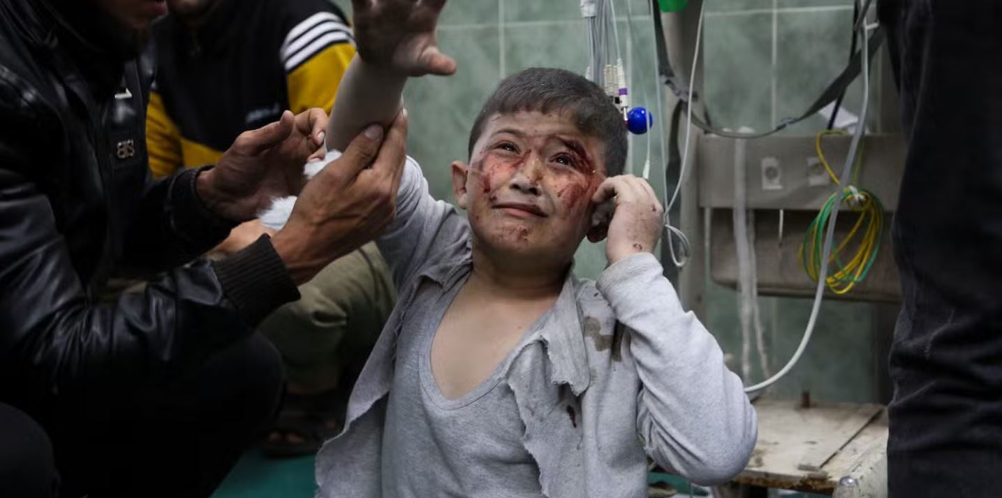 No childhood left: Gaza’s little ones fighting to breathe, eat, and survive