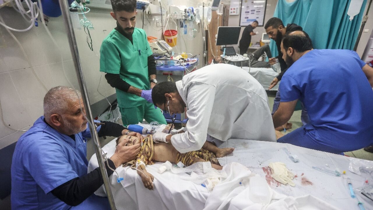Treating the untreatable: The exhausting battle of Gaza’s medical staff Treating the untreatable: The exhausting battle of Gaza’s medical staff