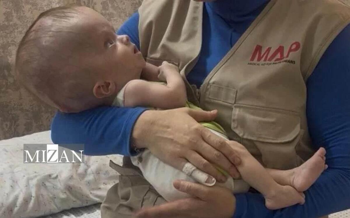 Famine’s hidden toll: Gaza sees spike in premature births and birth defects