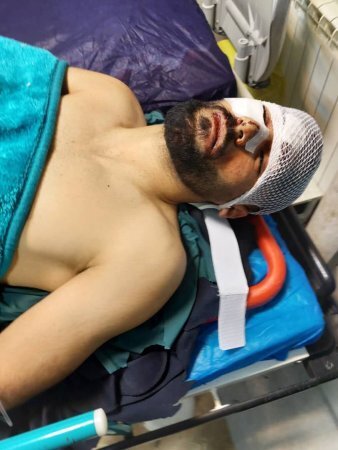 تصادف ناگوار مدافع ملیپوش پیکان/ خطر از بیخ گوش فلاح گذشت + عکس تصادف ناگوار مدافع ملیپوش پیکان/ خطر از بیخ گوش فلاح گذشت + عکس