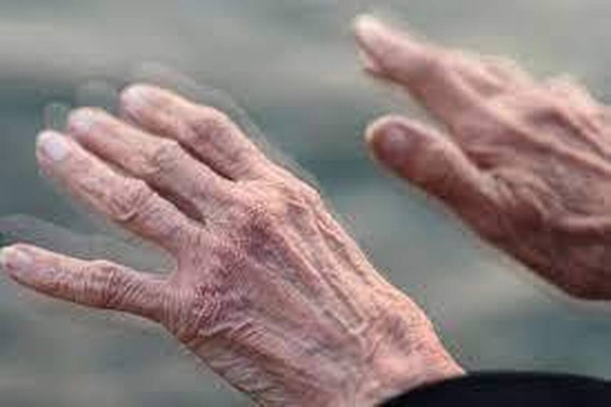 شیوع پارکینسون در حال افزایش است/ سنگ اندازی بیمه‌ها در تهیه دارو