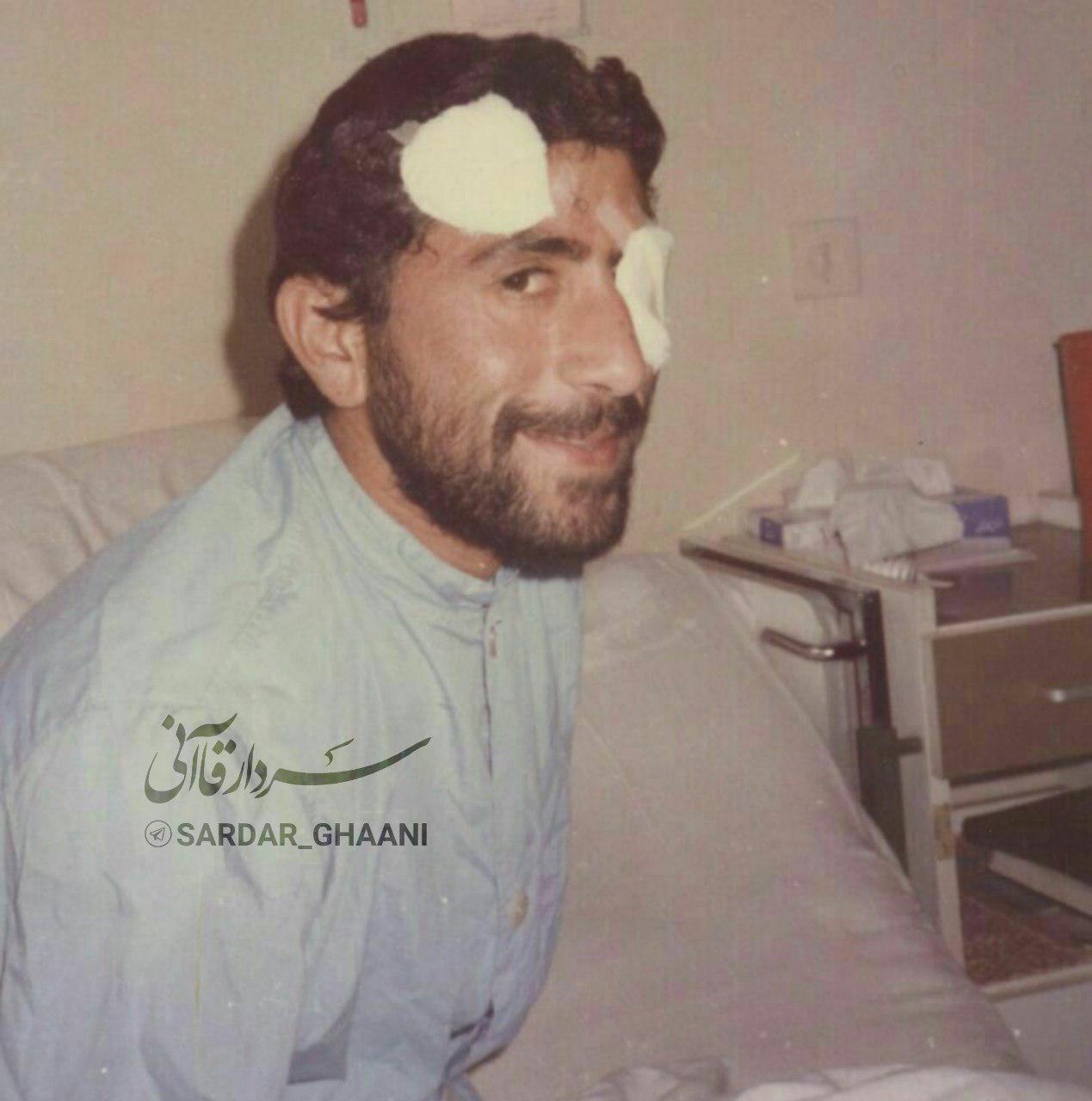 تصویری دیده نشده از جراحت چشم سردار قاآنی در جنگ
