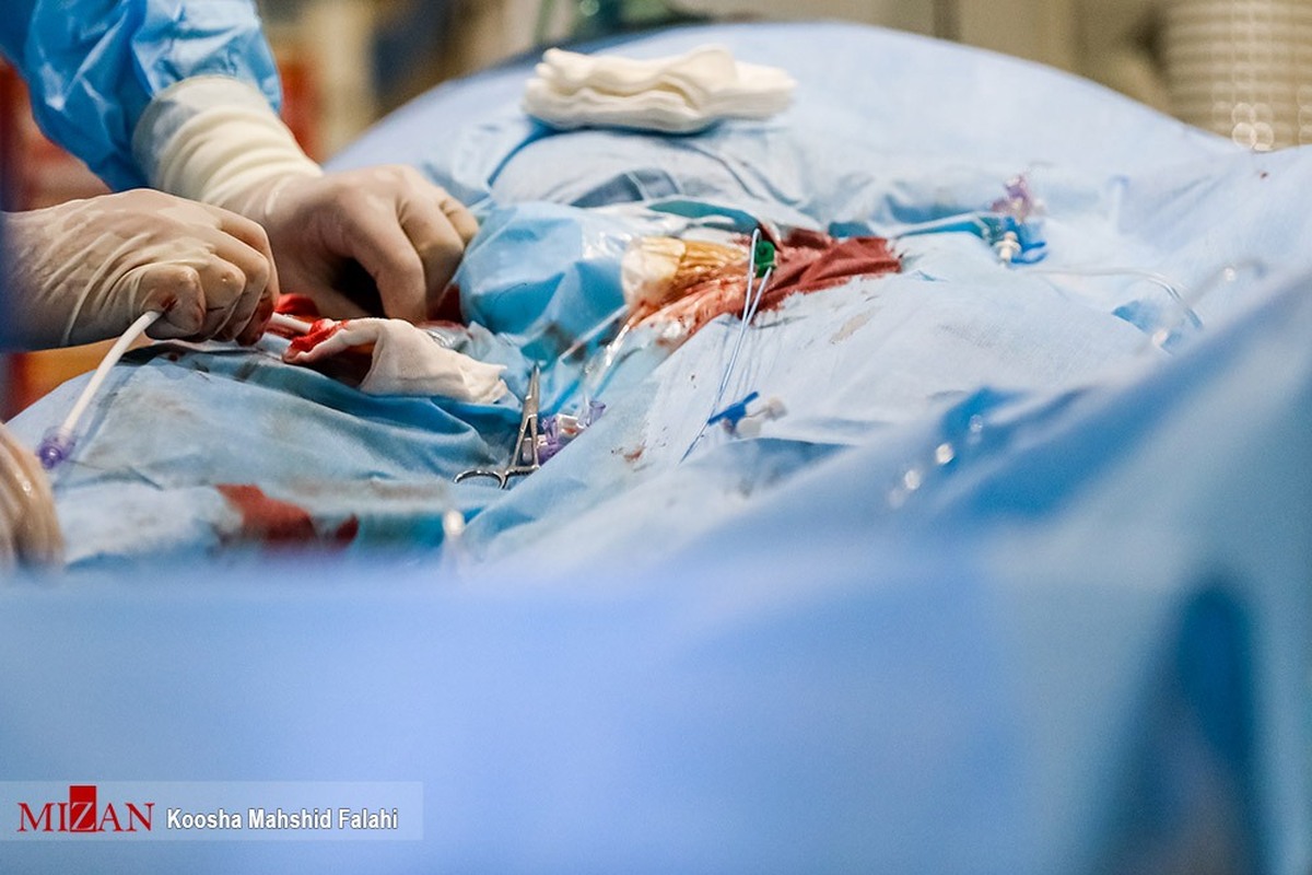 عمل جراحی فوق تخصصی تعویض کامل مفصل لگن برای نخستین بار در میرجاوه انجام شد