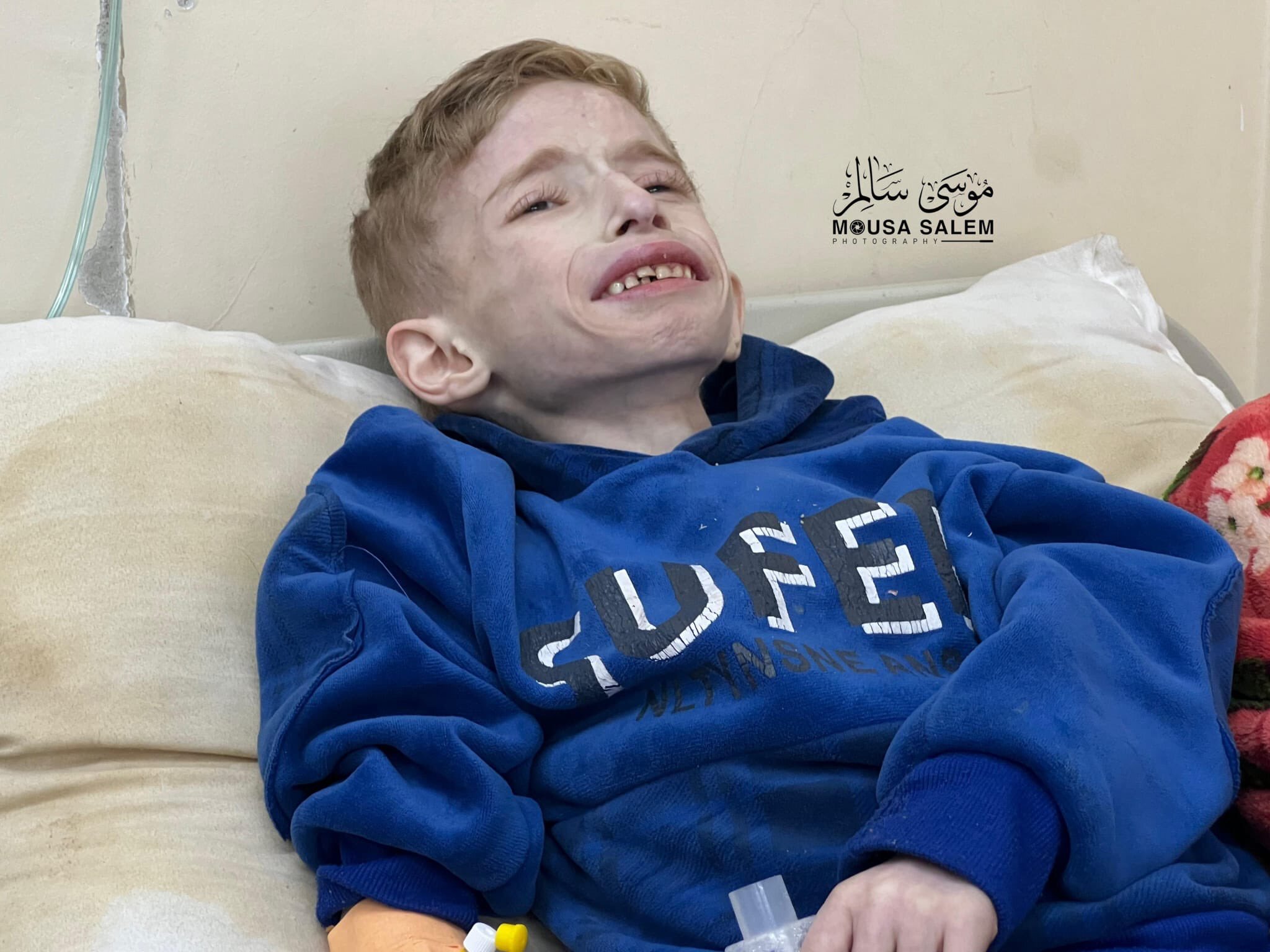 افزایش شمار شهدای سوءتغذیه و گرسنگی در نوار غزه؛ ۲۵ نفر به شهادت رسیدند افزایش شمار شهدای سوءتغذیه و گرسنگی در نوار غزه؛ ۲۵ نفر به شهادت رسیدند