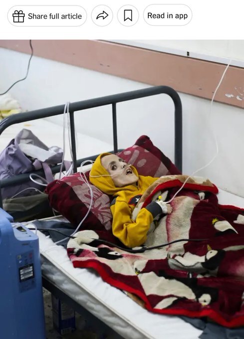 افزایش شمار شهدای سوءتغذیه و گرسنگی در نوار غزه؛ ۲۵ نفر به شهادت رسیدند افزایش شمار شهدای سوءتغذیه و گرسنگی در نوار غزه؛ ۲۵ نفر به شهادت رسیدند