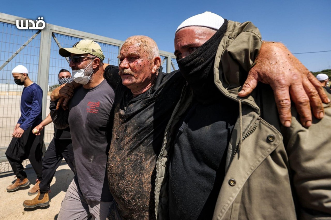 درگیری ساکنان جولان اشغالی با نظامیان رژیم صهیونیستی/ چند نفر زخمی شدند