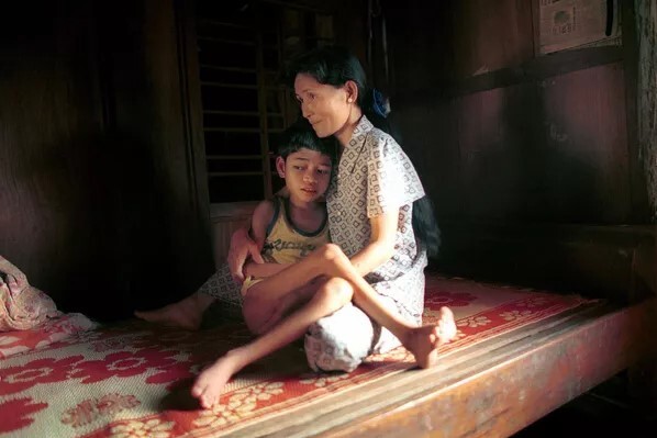 زندگی در جهنم به روایت تصویر؛ پیامد استفاده آمریکا از عامل نارنجی در جنگ ویتنام