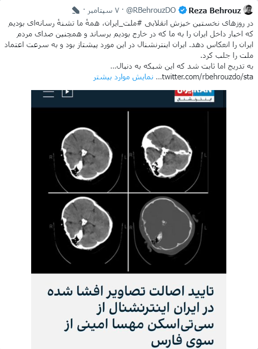اعتراف ضد انقلاب به دروغ بزرگ پس از یک‌سال؛ آیا به جمجمه مهسا امینی ضربه وارد شده بود؟
