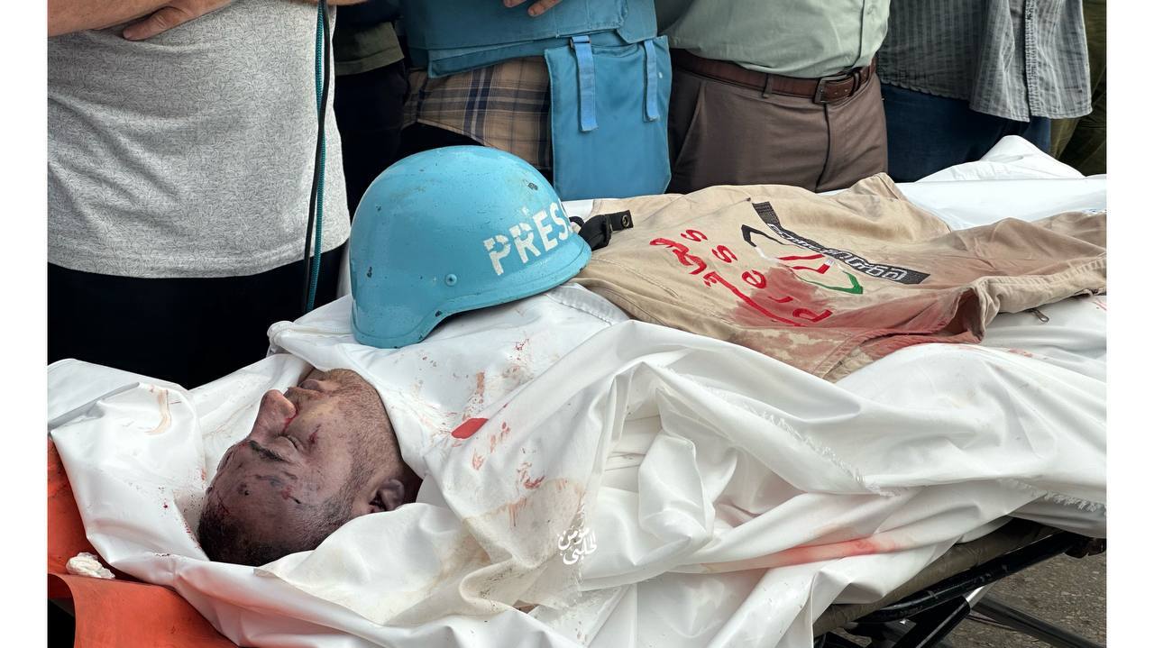 شمار شهدای فلسطینی به بیش از ۲ هزار و ۸۳۰ نفر افزایش یافت/ ادامه بمباران مناطق نوار غزه/شهرکهای صهیونیستنشین هدف عملیات راکتی مقاومت شمار شهدای فلسطینی به بیش از ۲ هزار و ۸۳۰ نفر افزایش یافت/ ادامه بمباران مناطق نوار غزه/شهرکهای صهیونیستنشین هدف عملیات راکتی مقاومت