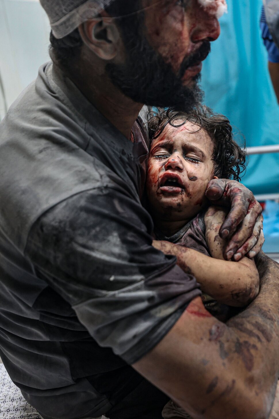 بیمارسنتان‌های غزه؛ وحشت و ترس آوارگان و مجروحان همزمان با حملات رژیم صهیونیستی