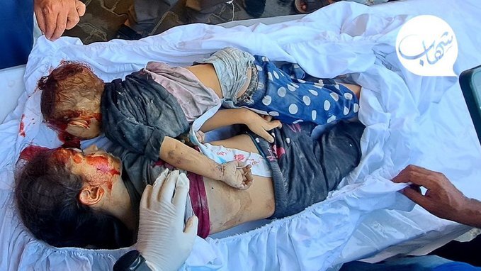 تصویری از خونین‌ترین تجاوزگری رژیم صهیونیستی علیه فلسطینی‌ها؛ زندگی در غزه چگونه می‌گذرد؟