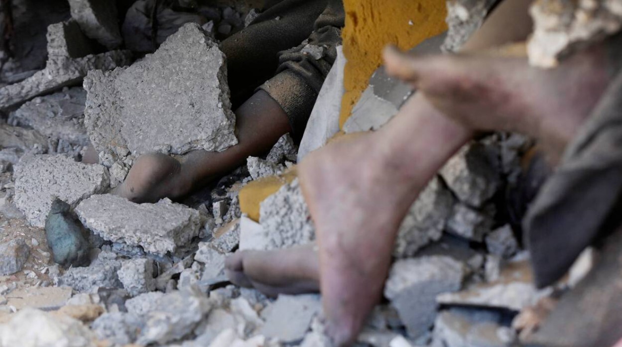 تراژدی زیر آوار ماندهها؛ غزه در پرتگاه شیوع بیماریهای همهگیر تراژدی زیر آوار ماندهها؛ غزه در پرتگاه شیوع بیماریهای همهگیر