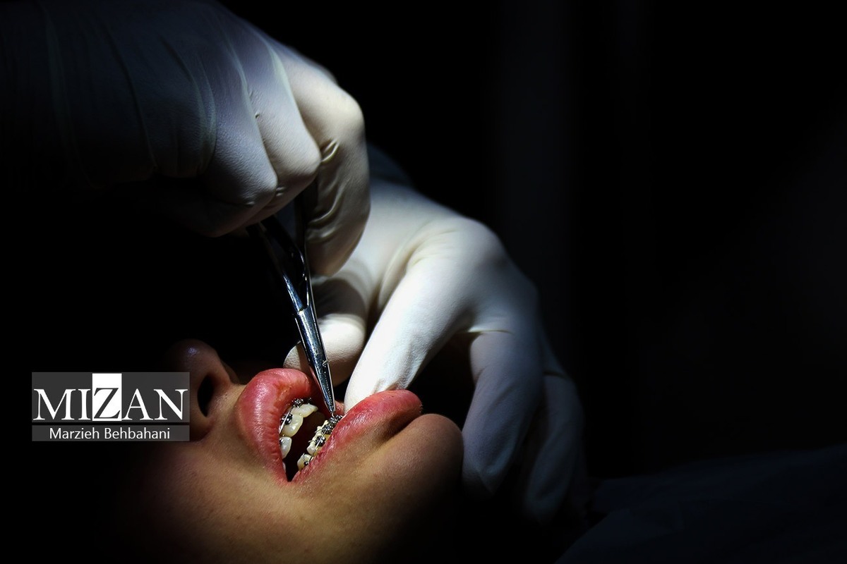 پلمپ کلینیک زیبایی در شهرری؛ دندانپزشک قلابی دستگیر شد