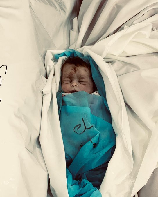 ناظر حقوق بشر اروپا: رژیم صهیونیستی عمدا زیرساخت‌های غیرنظامی را هدف قرار می‌دهد/ ۲۵ هزار شهید در ۷۰ روز