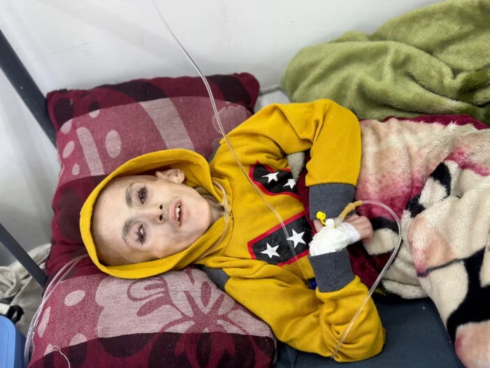 بخشهای بیمارستانی غزه مملو از کودکان قحطیزده بخشهای بیمارستانی غزه مملو از کودکان قحطیزده