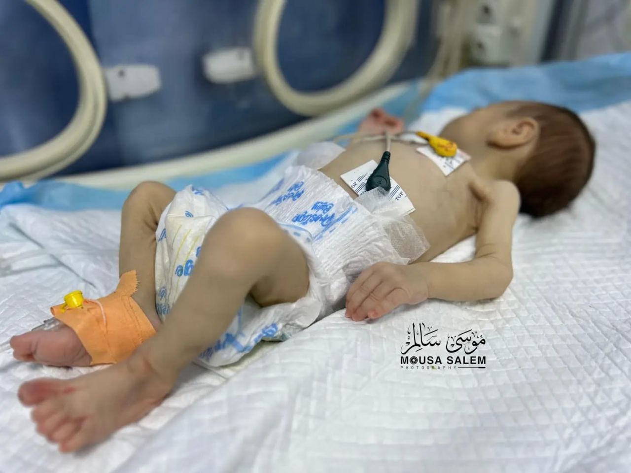 حملات رژیم صهیونیستی به اطراف بیمارستان الشفا/ حماس: رژیم اشغالگر قطعنامه‌های بین‌المللی را نادیده می‌گیرد