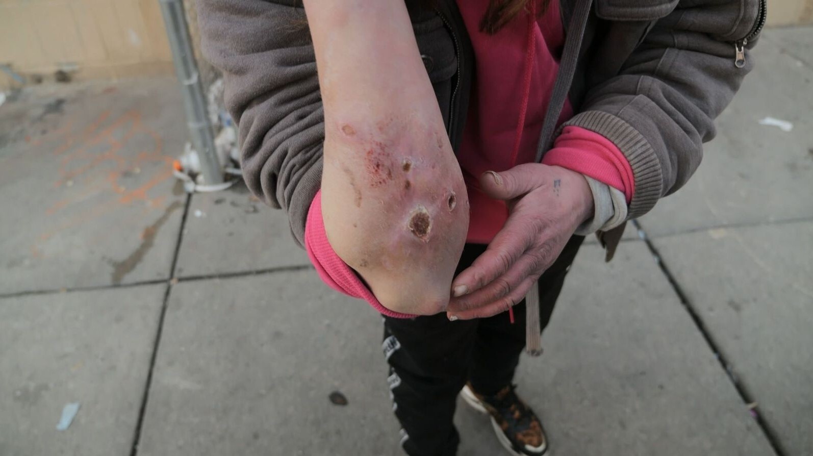 جولان مرگ‌بار زامبی گوشت‌خوار؛ از شکست انگلیس در مبارزه تا به‌صدا درآمدن زنگ هشدار در مکزیک