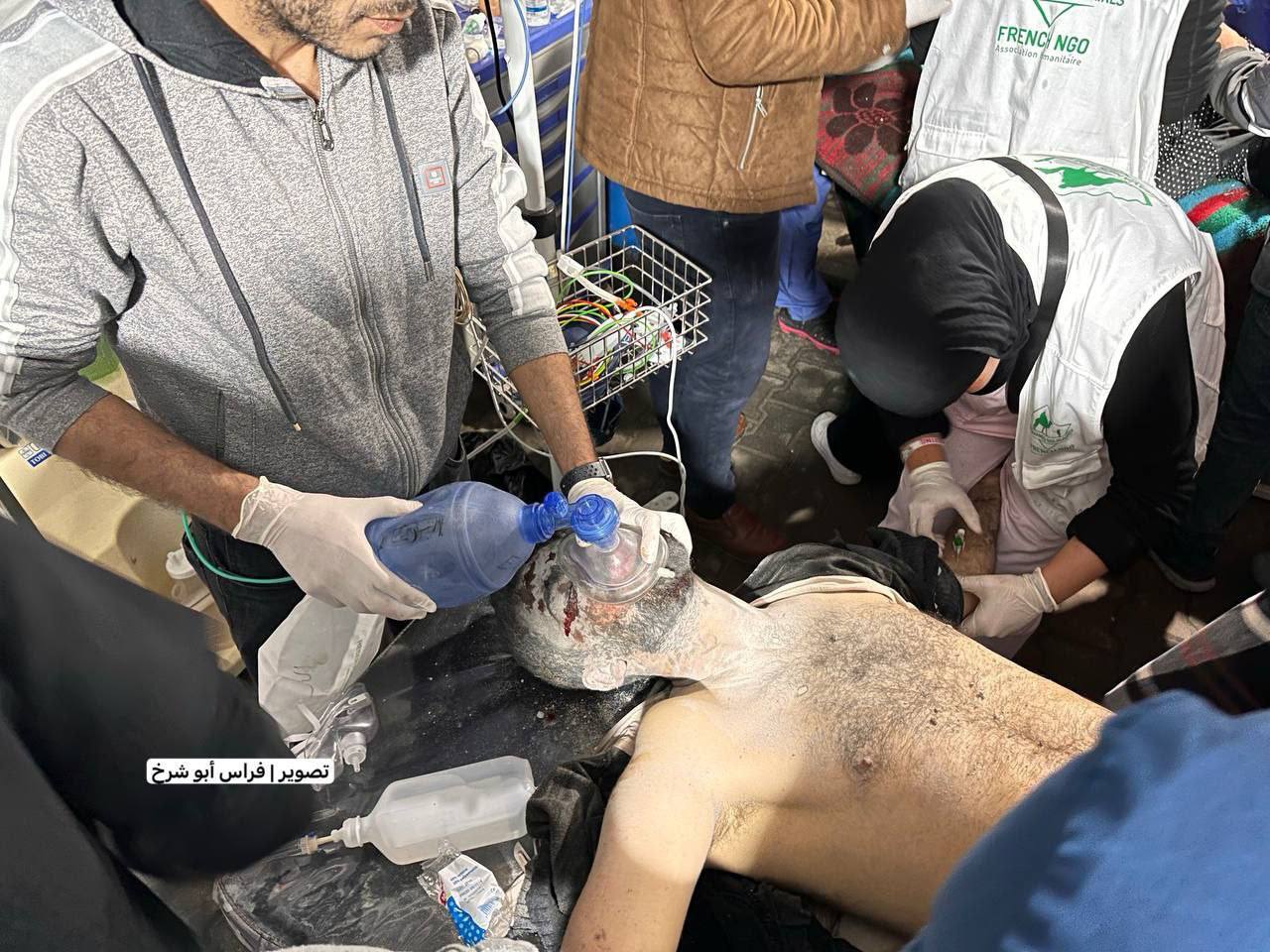 ادامه محاصره مراکز پزشکی غزه از سوی رژیم صهیونیستی/ یونیسف: کودکان بر اثر سوءتغذیه جان خود را از دست می‌دهند