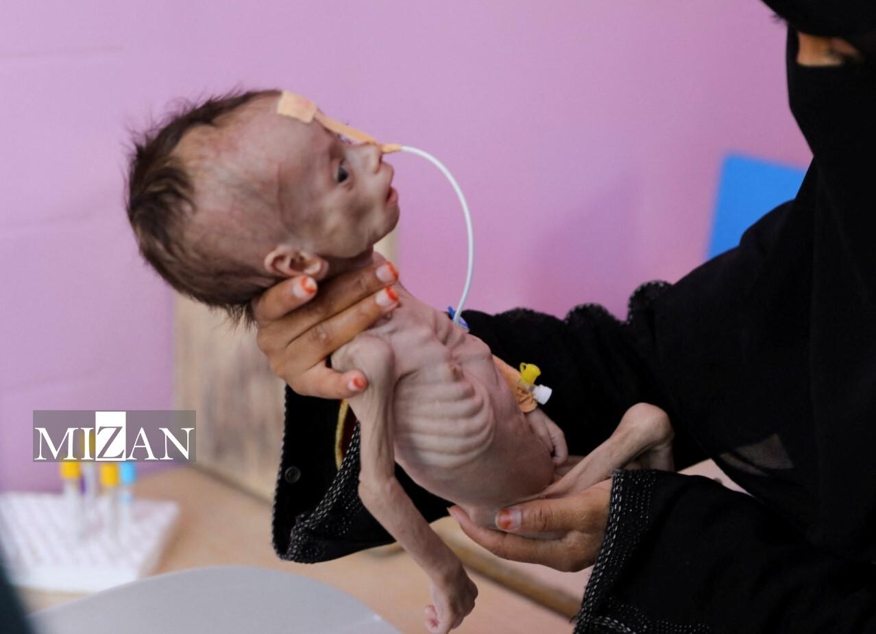 نسلی در معرض خطر سوءتغذیه؛ سهم قابل توجه کودکان غزه از ۱۳۰ میلیون کودک تحت تاثیر بحران