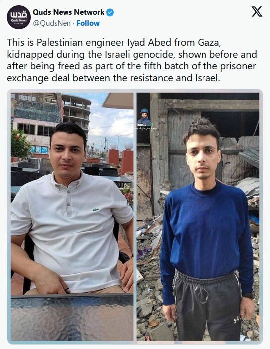 انتقال اسیران فلسطینی آزادشده از زندان‌های رژیم صهیونیستی به بیمارستان‌