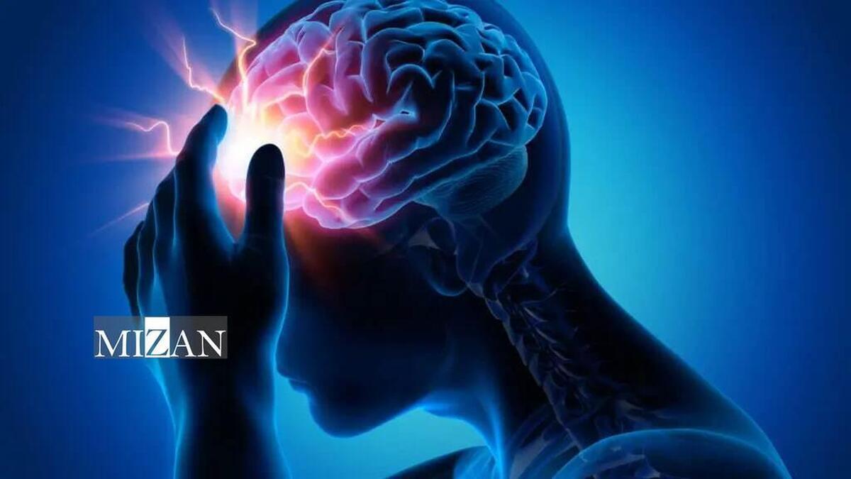 شیوع سکته مغزی در کشور سالانه تقریبا ۱۵۰ بیمار در ۱۰۰ هزار نفر