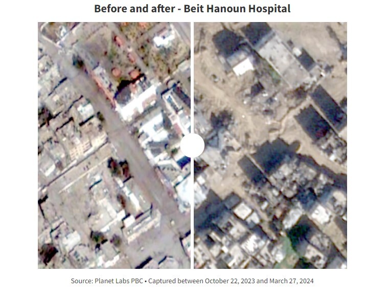 جنگ رژیم صهیونیستی علیه بیمارستان‌های غزه