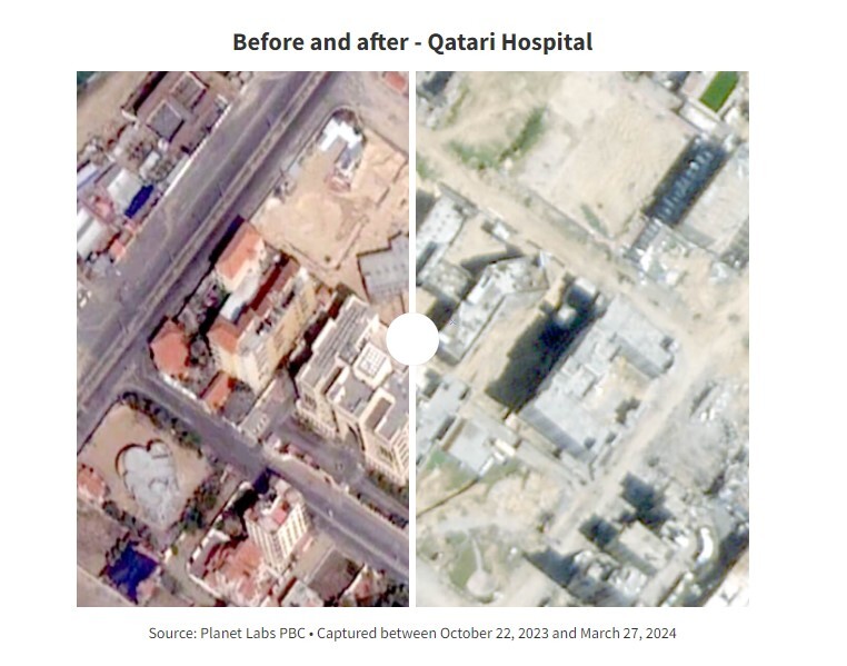 جنگ رژیم صهیونیستی علیه بیمارستان‌های غزه