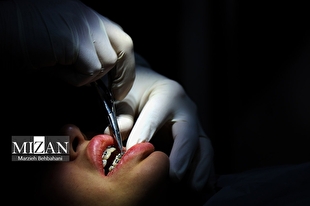 سلامت دهان و دندان؛ سرمنشا سلامتی قسمت‌های مختلف بدن
