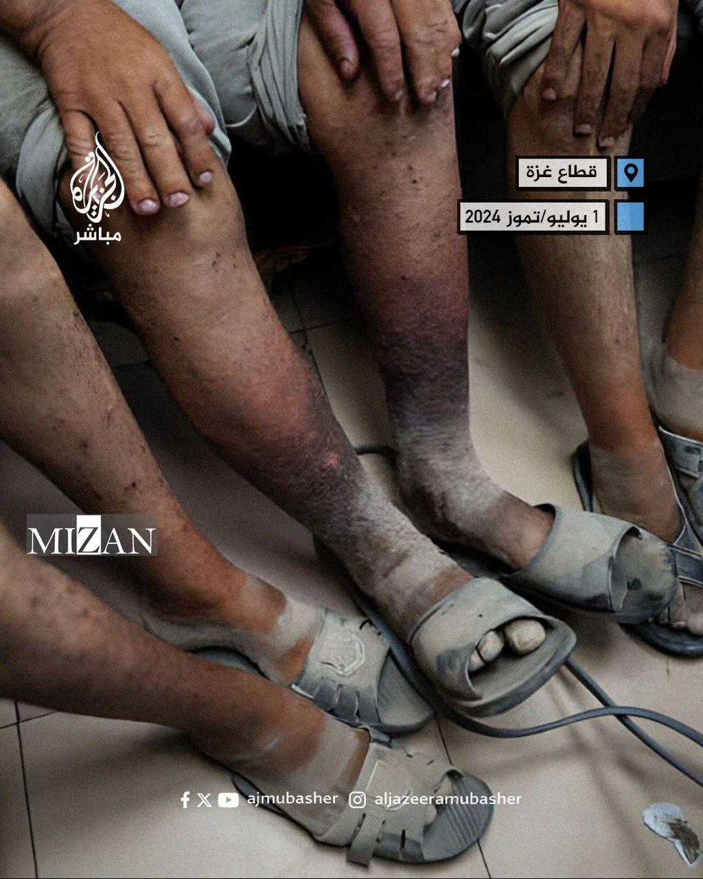 جنایت جنگی علیه اسرای فلسطینی در زندان‌های رژیم صهیونیستی