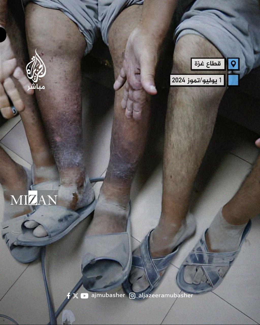 جنایت جنگی علیه اسرای فلسطینی در زندان‌های رژیم صهیونیستی