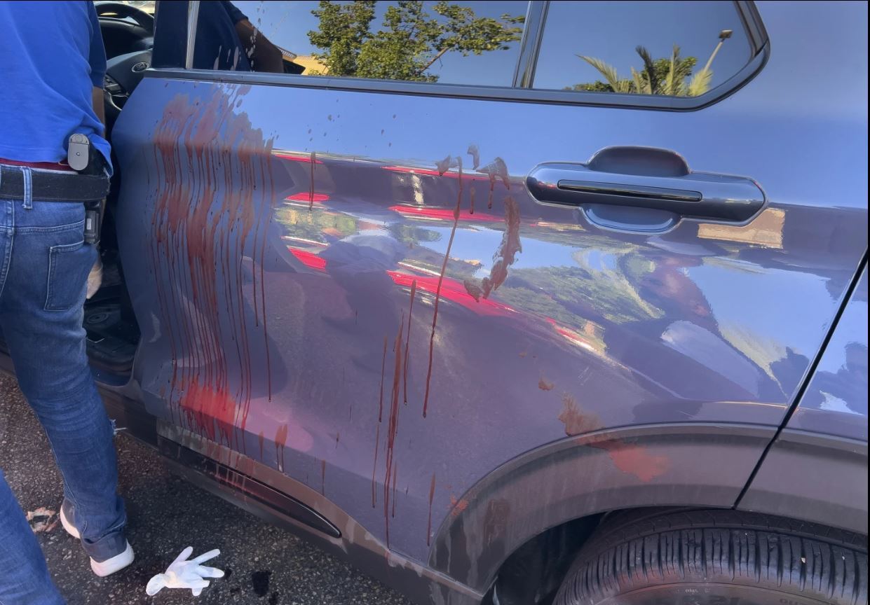 واکنش‌ها به انفجار پیجرها در لبنان؛ حزب‌الله: رژیم صهیونیستی منتظر تاوانی سخت باشد