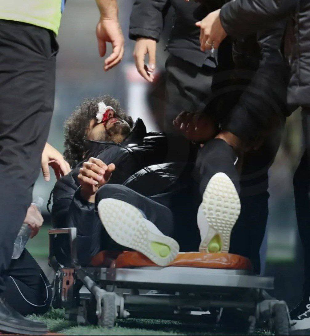 شجاعی ۲ بازیکن را کنار گذاشت/ اسماعیلی و برزای در اختیار کمیته انضباطی مس رفسنجان