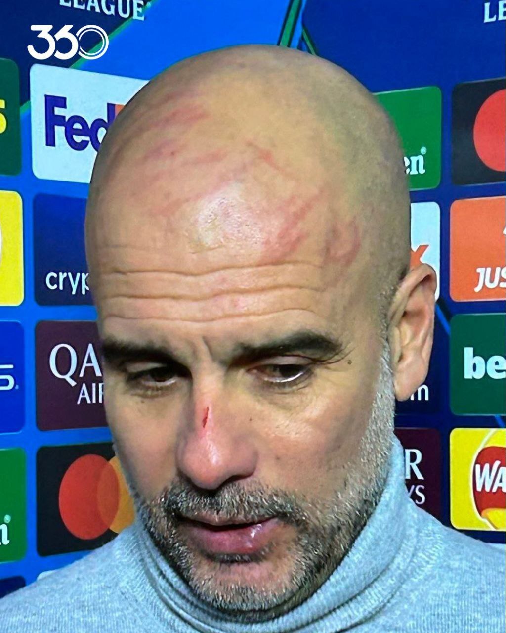 رونمایی از دلایل خودزنی عجیب گواردیولا بعد از تساوی غافلگیرکننده برابر فاینورد