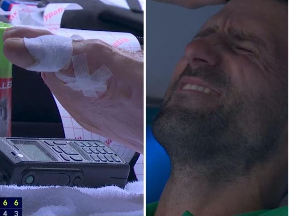 تنیس اوپن استرالیا| یکی از عجیب‌ترین بازی تورنمنت؛ جوکوویچ علی‌رغم تاول سنگین با خوش‌شانسی به نیمه‌نهایی رسید