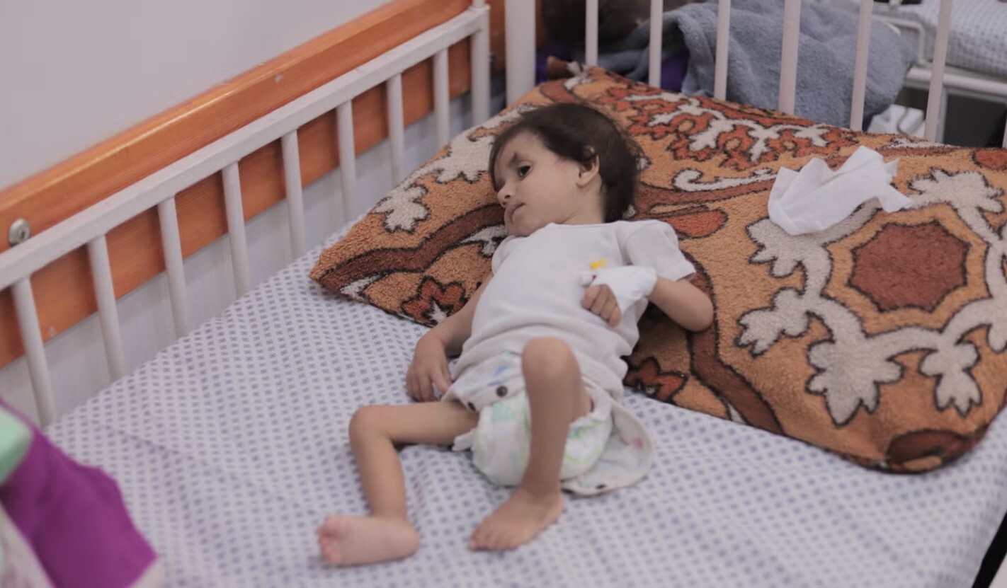 قربانیان فراموش‌شده سلاح‌سازی گرسنگی در غزه؛ نابینایی و مرگ کودکان