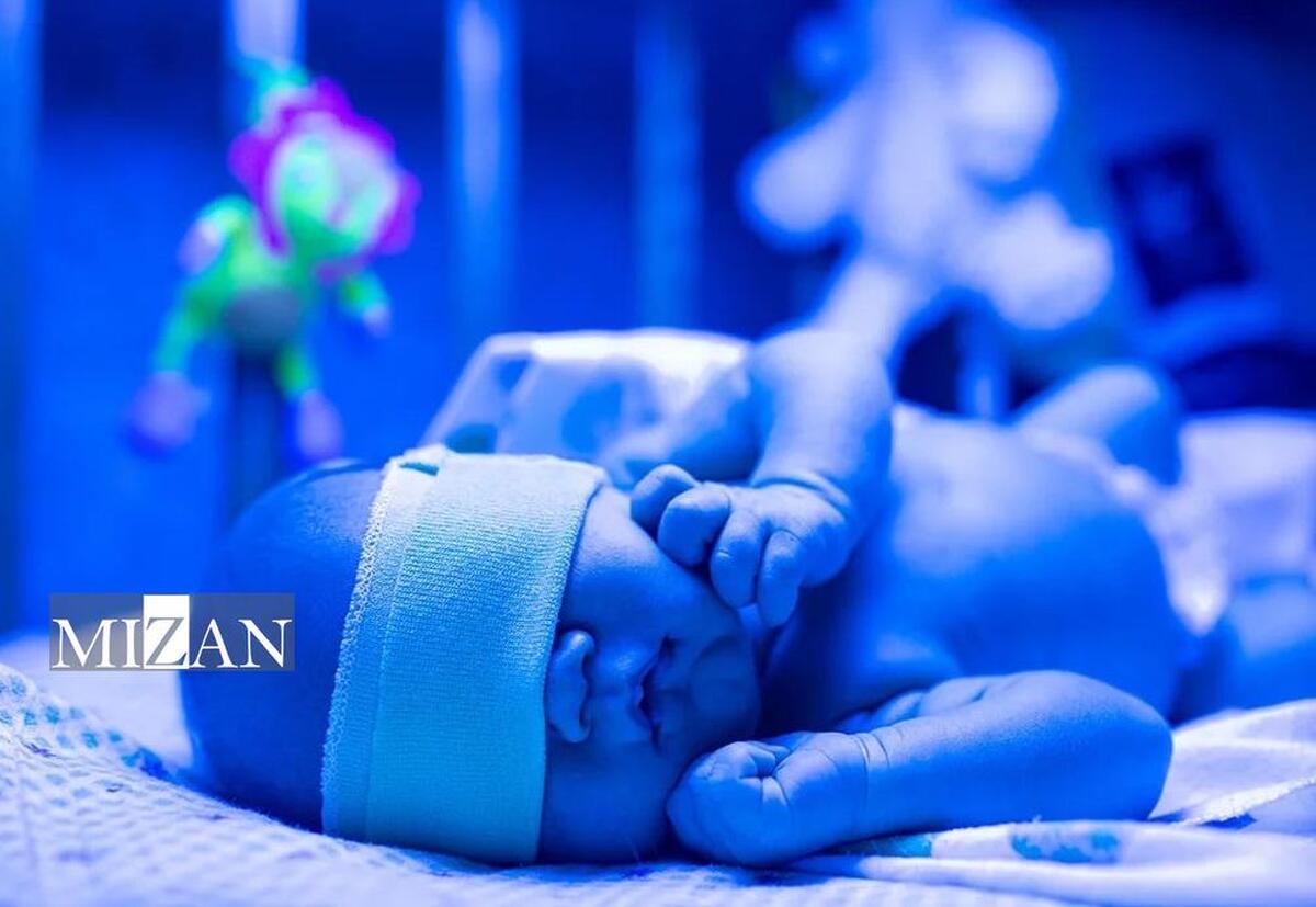 زردی نوزاد؛ شایع اما پرخطر در صورت بی‌توجهی