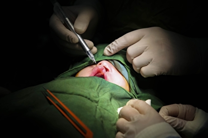 جراحی رایگان کودکان با ناهنجاری‌های مادرزادی