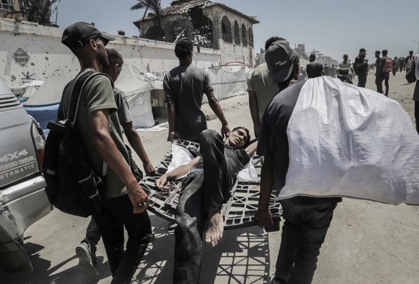 جولان مرگ بر اثر گرسنگی در غزه