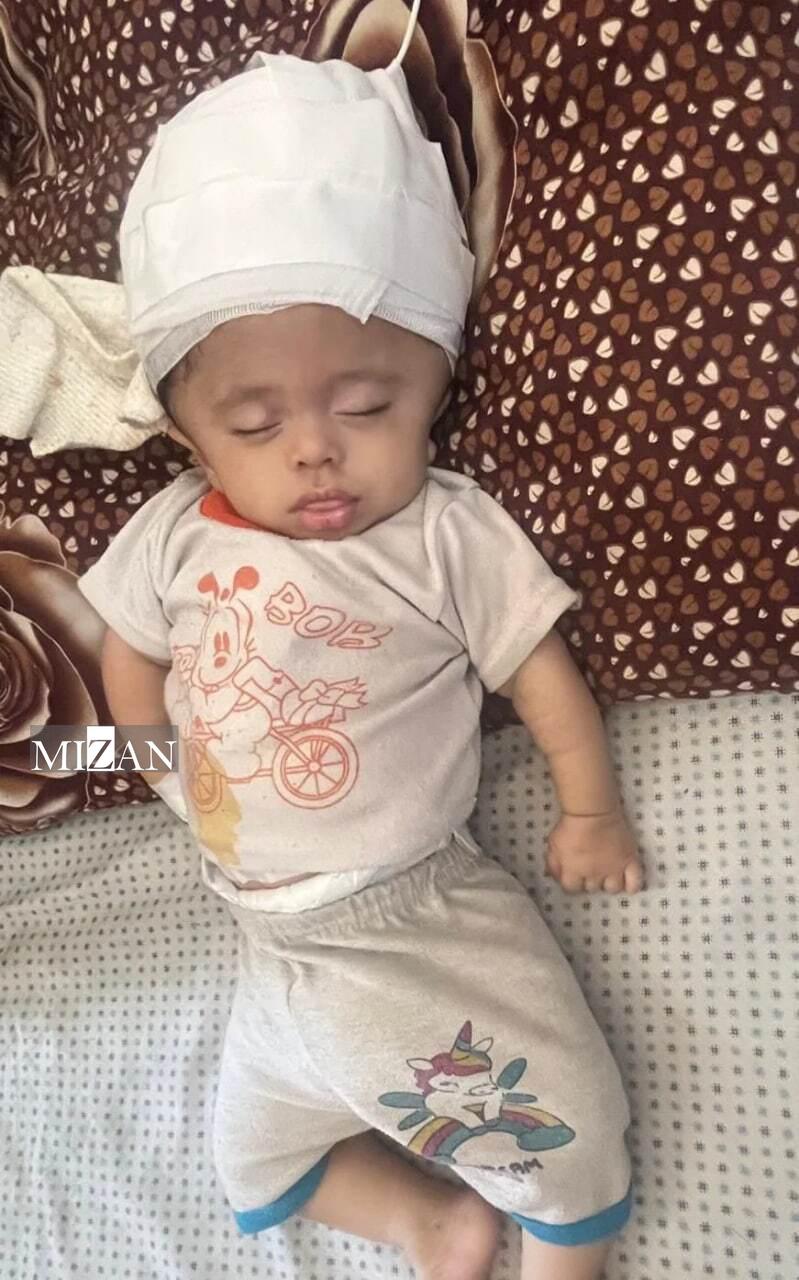 افزایش موارد نقص مادرزادی در غزه؛ نتیجه جنگ و قحطی تحمیلی رژیم صهیونیستی