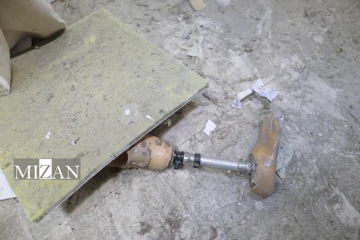 فاجعه قطع عضو در غزه؛ تراژدی انسانی در میانه جنایت نسل‌کشی