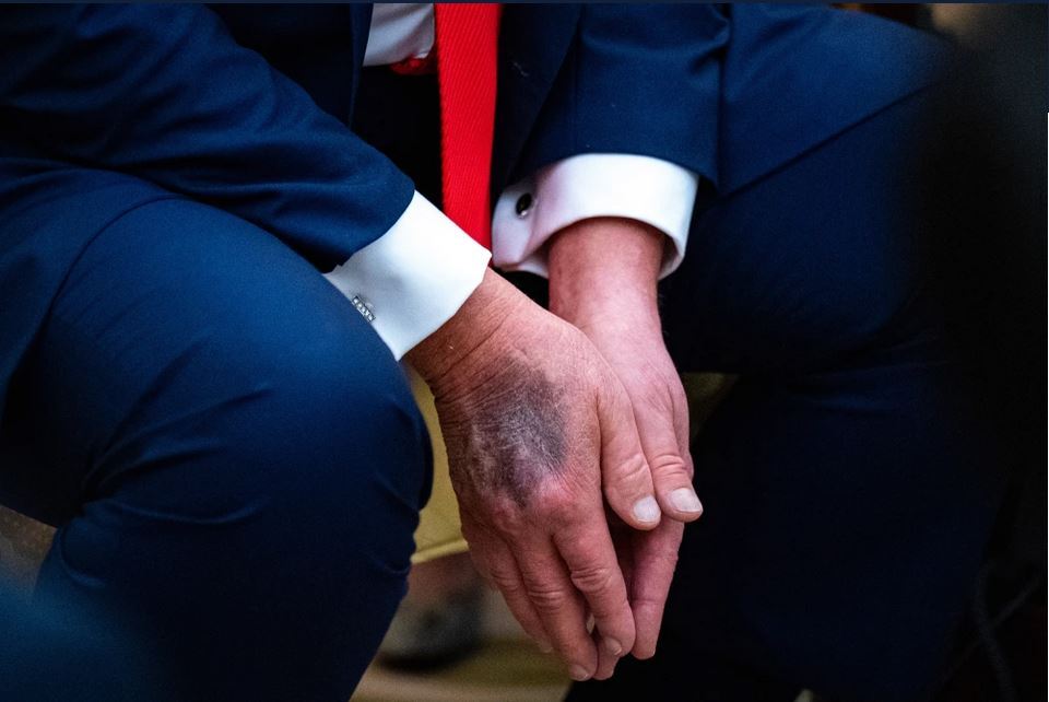 چالش دیرینه کاخ سفید با وضعیت سلامتی رؤسای جمهور