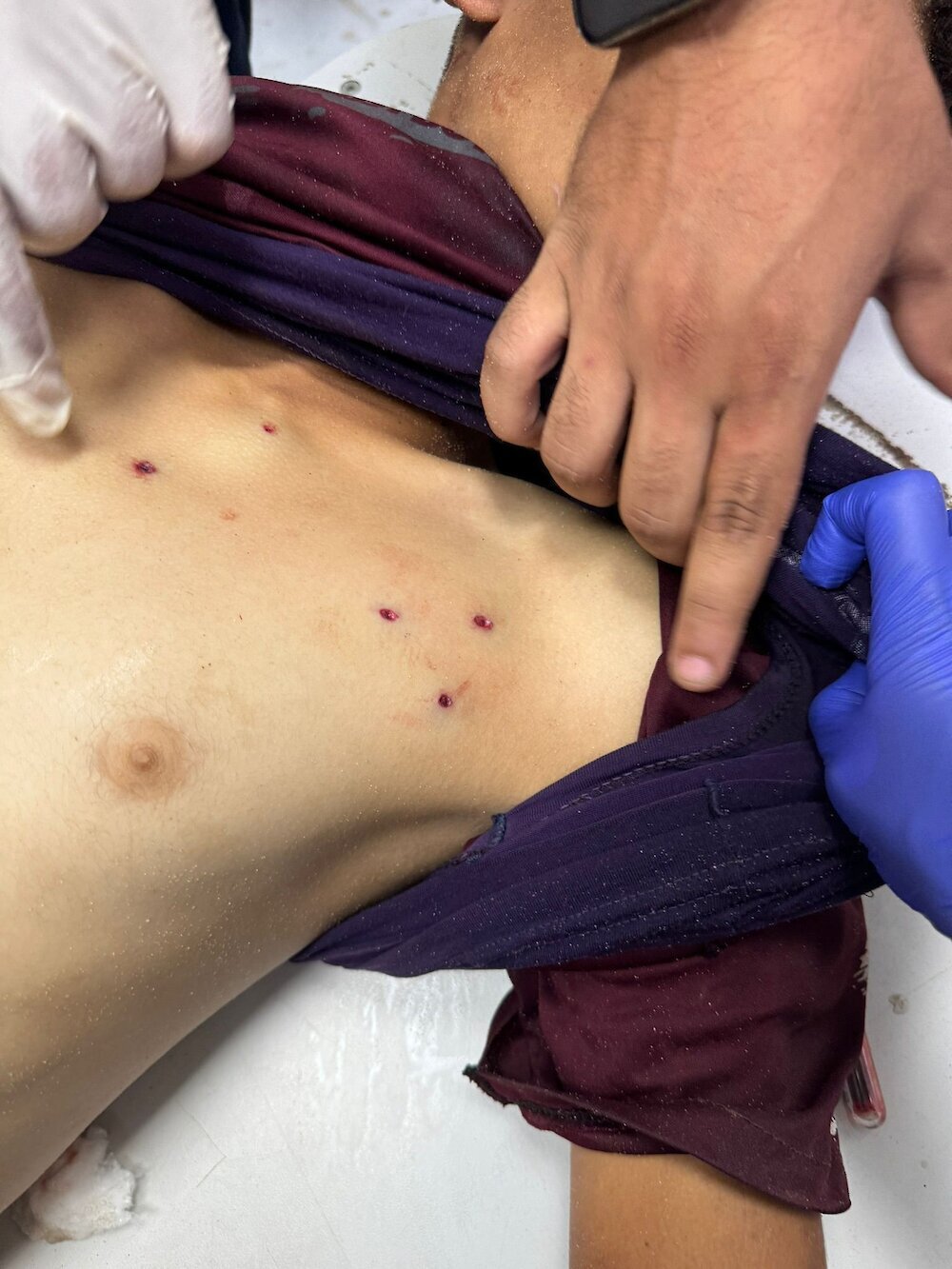 افشای ابعاد جدید جنایت صهیونیست‌ها در غزه؛ شلیک عمدی به سر و سینه کودکان فلسطینی