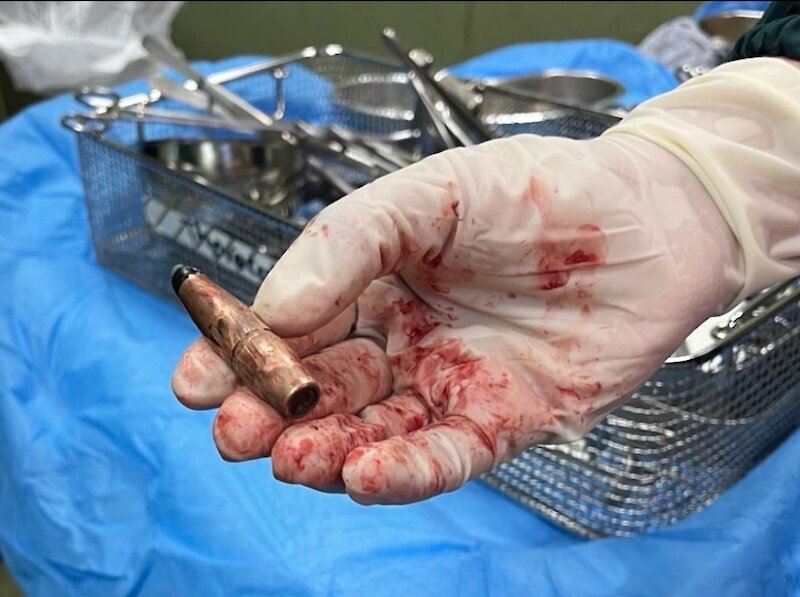 افشای ابعاد جدید جنایت صهیونیست‌ها در غزه؛ شلیک عمدی به سر و سینه کودکان فلسطینی