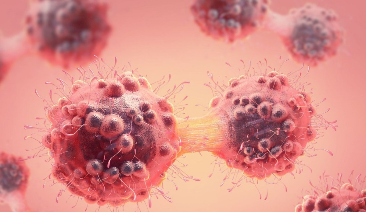 راهکار‌های اطلاع‌رسانی پیشگیری از سرطان بررسی شد