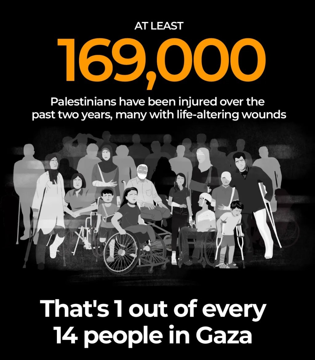 مجروحیت یک نفر از هر ۱۴ فلسطینی در غزه نسلکشی ۲ ساله رژیم صهیونیستی در غزه از دریچه اعداد
