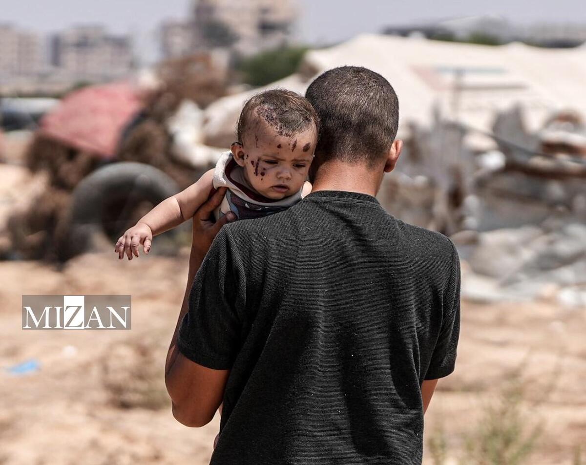 تداوم رنج کودکان یتیم مجروح غزه فراتر از آتش‌بس