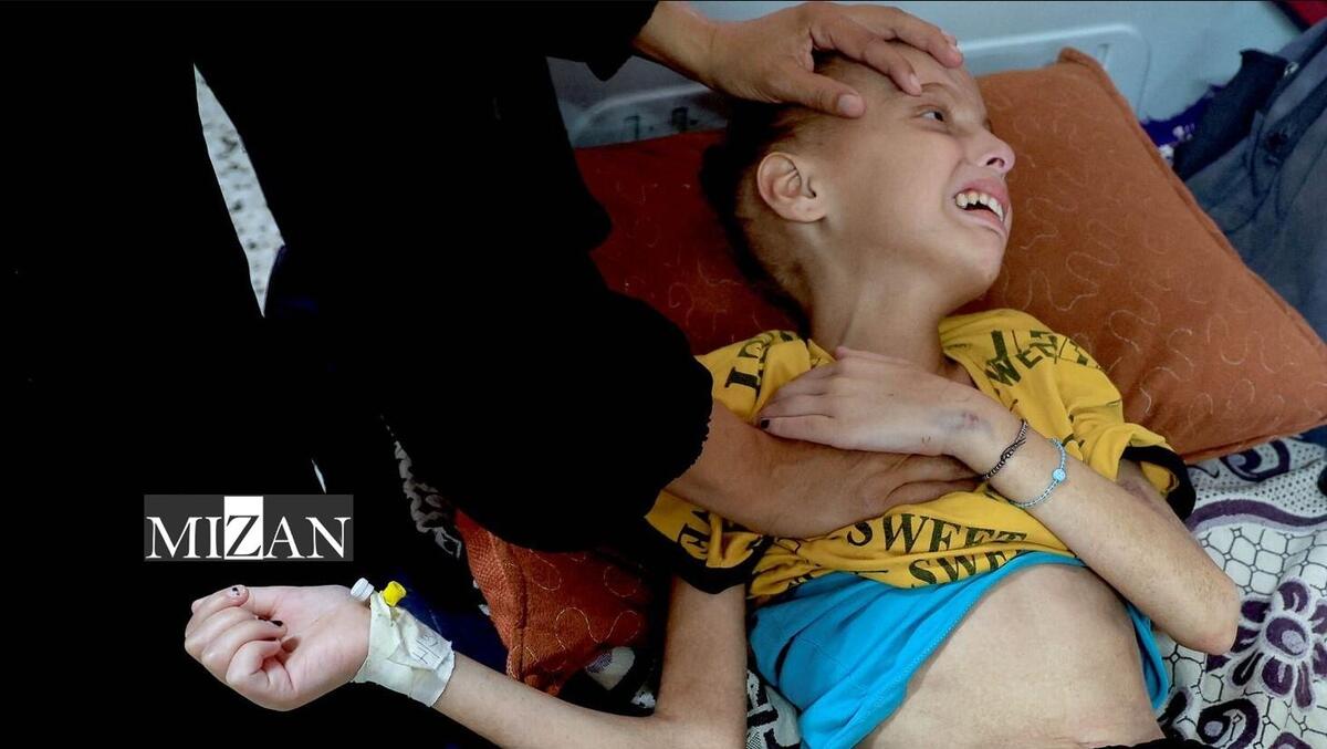 ابتلای ۵۵ هزار کودک غزه به سوءتغذیه حاد