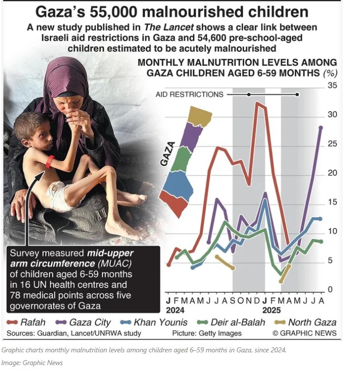 آمار سوءتغذیه در غزه