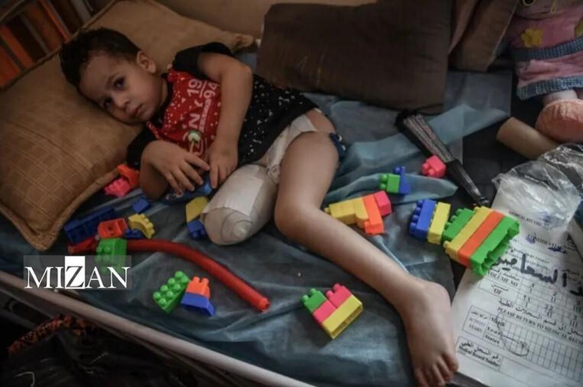 سازمان جهانی بهداشت: دست‌کم ۱۵ هزار نفر بر اثر جنگ غزه قطع عضو شدند